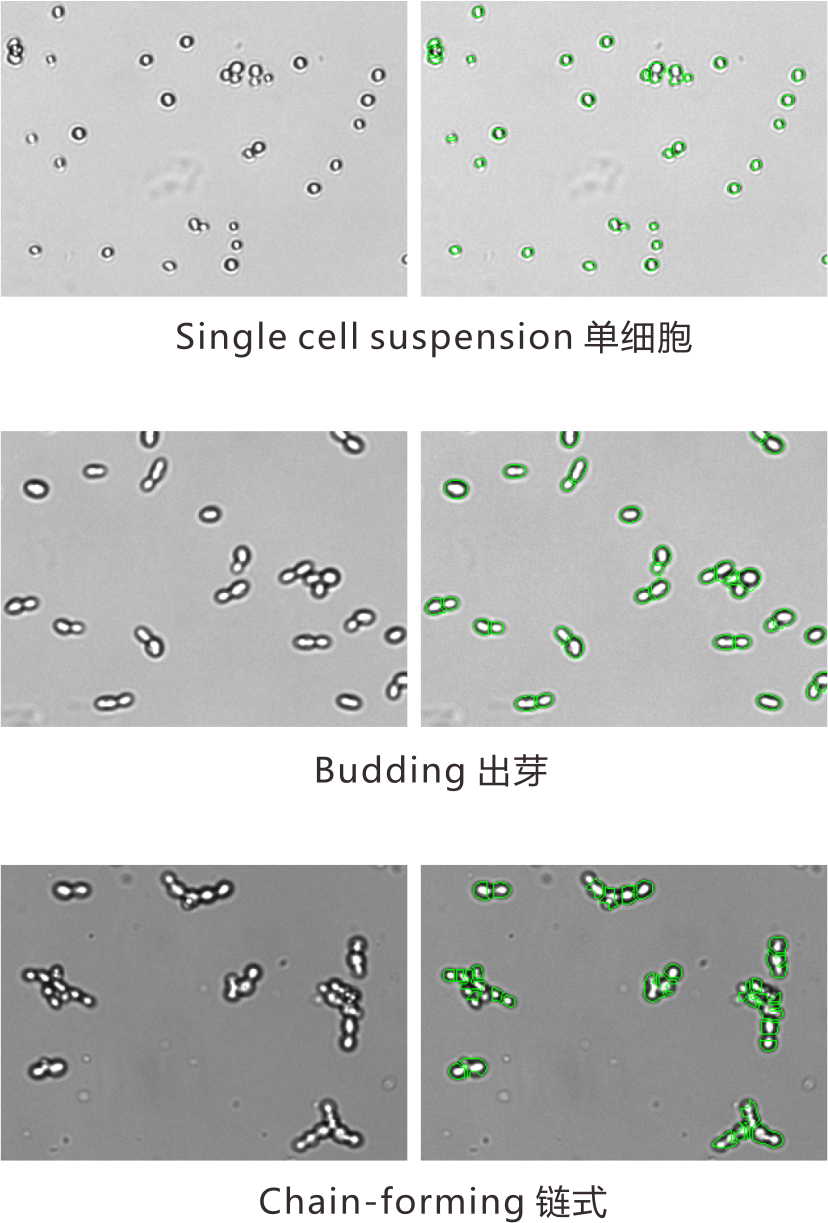 yeast BF cell counting.png